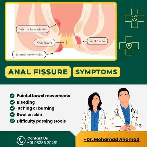 Fissure in Ano Pack